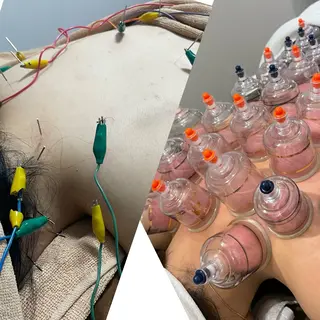 美容鍼/鍼灸 ここみ鍼灸院のエステ・リラクイメージ