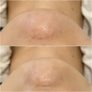 ララ/ハーブ メゾンリュバンのエステ・リラクイメージ