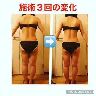 セミロング カラー パーマ ヘアアレンジ メンズ キッズ ネイル マツエク・マツパ アニメ,Vオタク× 即効痩せエステサロンのエステ・リラクイメージ