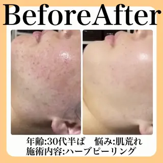 毛穴・たるみ･ニキビケア専門サロンsui所属・sui【スイ】 ARISAのエステ・リラクイメージ