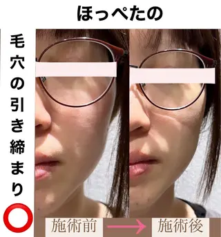 脱毛&美容サロンBLUESEA所属・脱毛&美容サロン BLUESEAのエステ・リラクイメージ