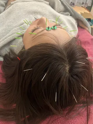 美容鍼灸女性専用 りんご鍼灸治療院のその他イメージ