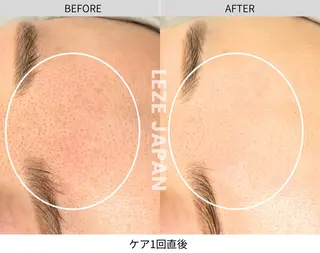 LA CLARTE所属・LA CLARTEのエステ・リラクイメージ