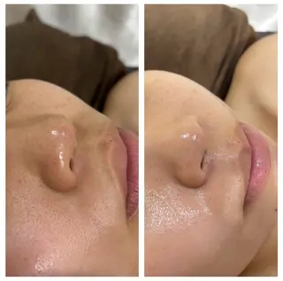 HAKUBI フェイシャルサロンのエステ・リラクイメージ