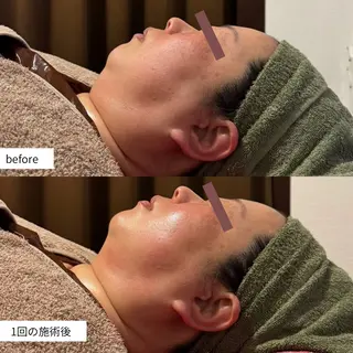 なにわのシミ取り職人 YUKIのエステ・リラクイメージ