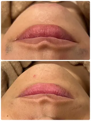 PBS脱毛サロン鶯谷店所属・脱毛/BBL/SHR PBSサロンAirのエステ・リラクイメージ