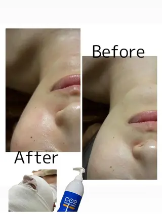 【敏感肌管理×小顔サロン】Belle orchid所属・敏感肌×小顔サロン 玲央奈のエステ・リラクイメージ