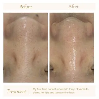 AY'S所属・倉敷/玉島/20代 からの大人毛穴洗浄のエステ・リラクイメージ