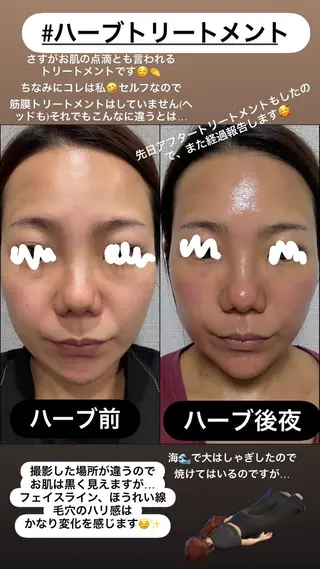 LiZA エステティックサロンのエステ・リラクイメージ