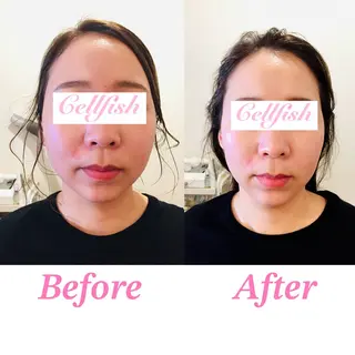 Cellfish ～セルフィッシュ～のエステ・リラクイメージ