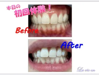 セルフホワイトニングサロン　ラヴィアン所属・ホワイトニングサロン La vie enのその他イメージ