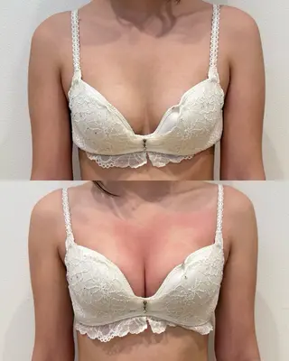 beautysalon RAVIS所属・東大阪/韓国肌管理/ 痩身バスト専門店のエステ・リラクイメージ