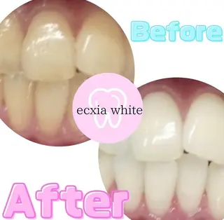 エクシアホワイトニング草津店所属・nanami -ホワイトニングのその他イメージ