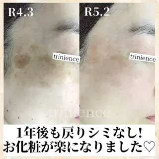 シミケア肌改善専門 トリニエンス新宿店のその他イメージ