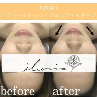 心斎橋痩身ダイエット 韓国.美容鍼.小顔のエステ・リラクイメージ