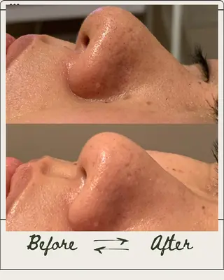 Linné  Yomogi Spa所属・Linné Amiのエステ・リラクイメージ