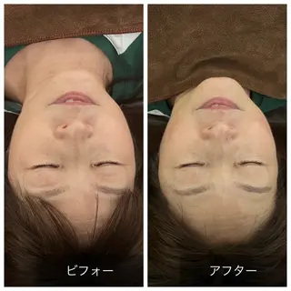 Relaxsalon undo所属・Relaxsalon undoのエステ・リラクイメージ