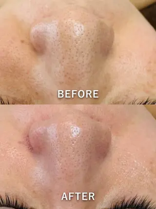 LukeBeauty salonのエステ・リラクイメージ