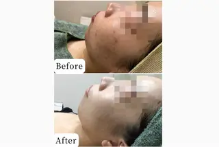 ハーブピーリング専門 muro.のエステ・リラクイメージ