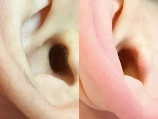 Hit. シュガーリング豊橋のエステ・リラクイメージ