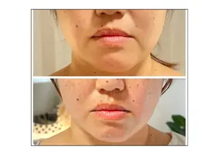 LaLa所属・小顔・たるみケア 専門店【LaLa】のエステ・リラクイメージ