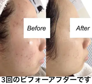 セミロング カラー パーマ ヘアアレンジ キッズ ネイル マツエク・マツパ 都度払い肌質改善 &脱毛Blancheのエステ・リラクイメージ