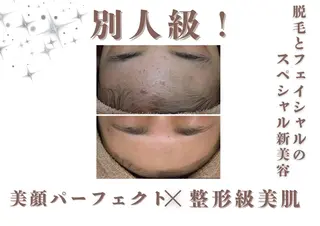 🌷U24特別サロン レイビス銀座店🌷のエステ・リラクイメージ