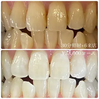 メンズ ホワイトニングルーム　川崎店所属・ホワイトニング ルーム　川崎店のその他イメージ