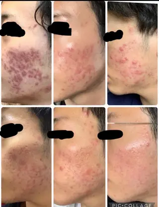 ショート カラー パーマ ヘアアレンジ メンズ キッズ マツエク・マツパ アイブロウ 肌質体質を変えて すっぴん肌にのエステ・リラクイメージ