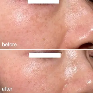 ナスサロasuka. 🕯️🤎のエステ・リラクイメージ