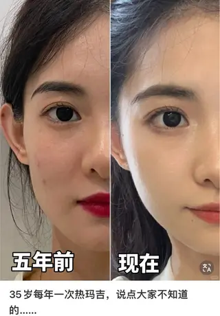 マツエク・マツパ aliaハイフ&水光ジェットサロン所属・aliaハーブ水光店 エステティシャン募集のエステ・リラクイメージ