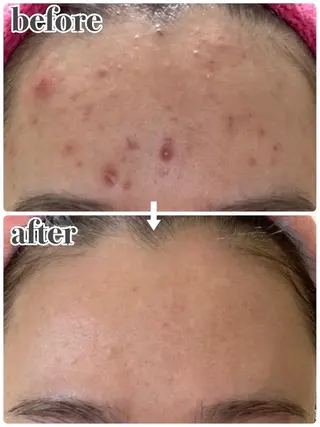 RinRin 津店のエステ・リラクイメージ