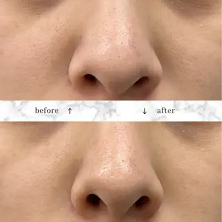 フェイシャルエステ♡ KAORIのエステ・リラクイメージ