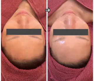 ハーブピーリングMB eautySalonのエステ・リラクイメージ