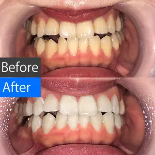 ネイル アイブロウ マツエク・マツパ ショート パーマ メンズ キッズ カラー 中目黒 ホワイトニングサロンのその他イメージ