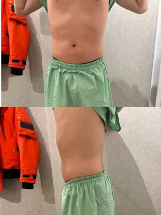 メンズ 腸活サポート みなみののエステ・リラクイメージ