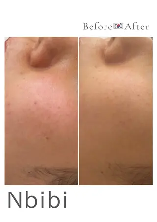 韓国🇰🇷価格 サロン_Nbibiのエステ・リラクイメージ