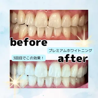 ホワイトニングサロン Soleilのその他イメージ