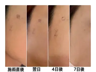 シミ・毛穴ケア専門 Lunaのエステ・リラクイメージ