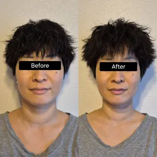 小顔矯正 LNのエステ・リラクイメージ