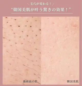 美肌育成専門サロンラクシュミー所属・毛穴肌管理サロン ラクシュミーのエステ・リラクイメージ