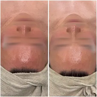 小澤 joieange京橋のエステ・リラクイメージ