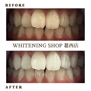 メンズ ホワイトニング ショップ葛西店のその他イメージ