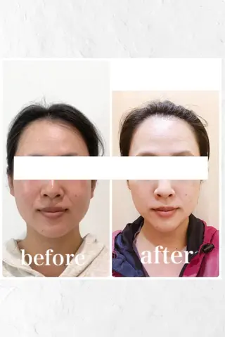 小顔と ヘッドスパのお店のエステ・リラクイメージ