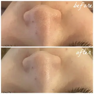 メンズ メナード岐阜市茜部 杉浦のエステ・リラクイメージ