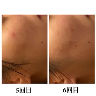 Bellesthe （ベルエステ）のエステ・リラクイメージ