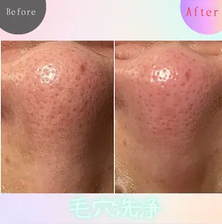 プライベートサロン リュッカのエステ・リラクイメージ