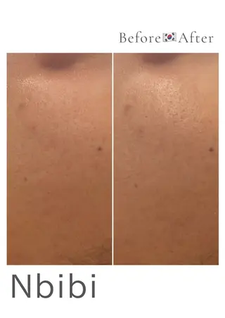 韓国🇰🇷価格 サロン_Nbibiのエステ・リラクイメージ