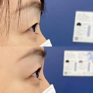 マツエク・マツパ 眉毛とまつ毛の専門店 アイルのマツエク・マツパデザイン