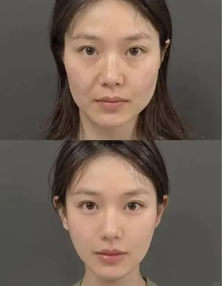 ショート aliaハイフ&水光ジェットサロン所属・aliaハーブ水光店 エステティシャン募集のエステ・リラクイメージ